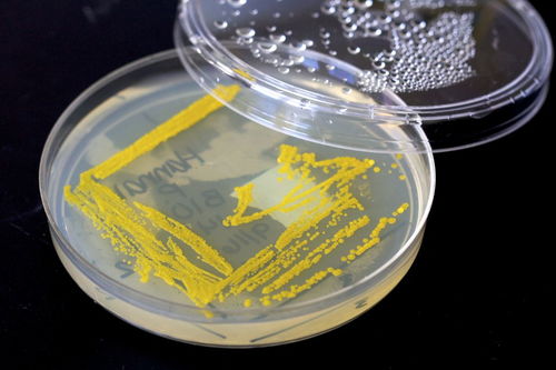培养不同微生物不可盲目使用同一培养基 微生物的复杂餮养密码